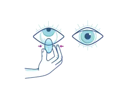 Verifique se as Lentes de Contacto estão na posição correta