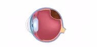 Melanoma Ocular: o que é, sintomas e tratamentos Melanoma Ocular: o que é, sintomas e tratamentos